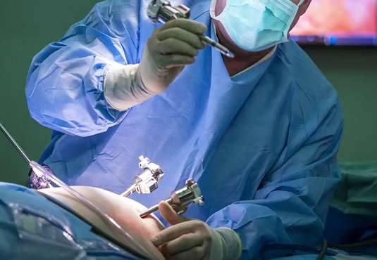 Geschlossene Gallenblasenoperation