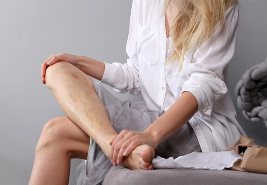 Krampfaderbehandlung