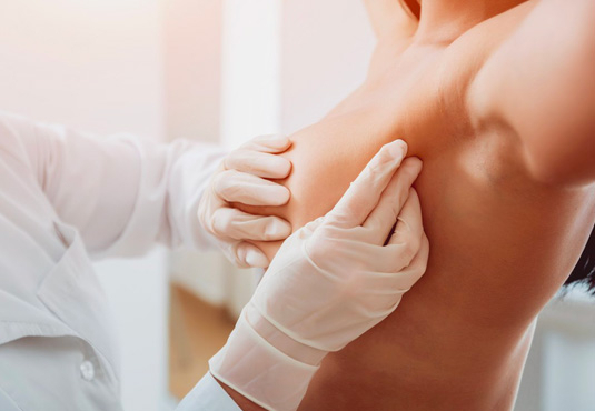 Stadien von Brustkrebs